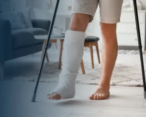 MEI tem direito ao recebimento de auxílio-acidente?